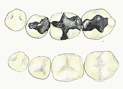 dental filling for Riverdale and Roy UT